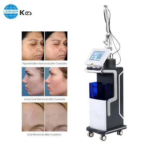 40w 10600nm Trixel Fraksiyonel Co2 Lazer El Aleti Fraksiyonel Co2 Fraksiyonel Lazer Cilt Yenileme